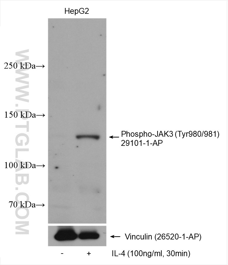 Western Blot (WB) analysis of various lysates using Phospho-JAK3 (Tyr980/981) Polyclonal antibody (29101-1-AP)