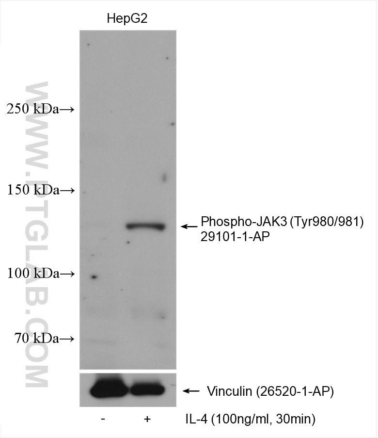 WB analysis using 29101-1-AP