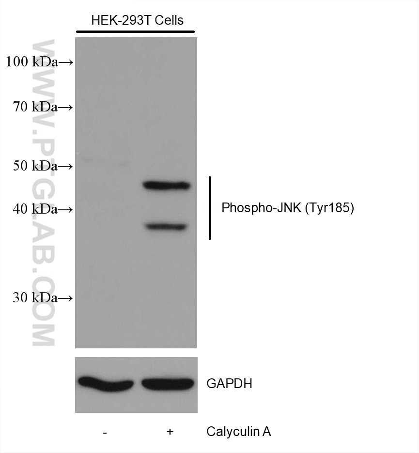 Western Blot (WB) analysis of various lysates using Phospho-JNK (Tyr185) Recombinant antibody (80024-1-RR)