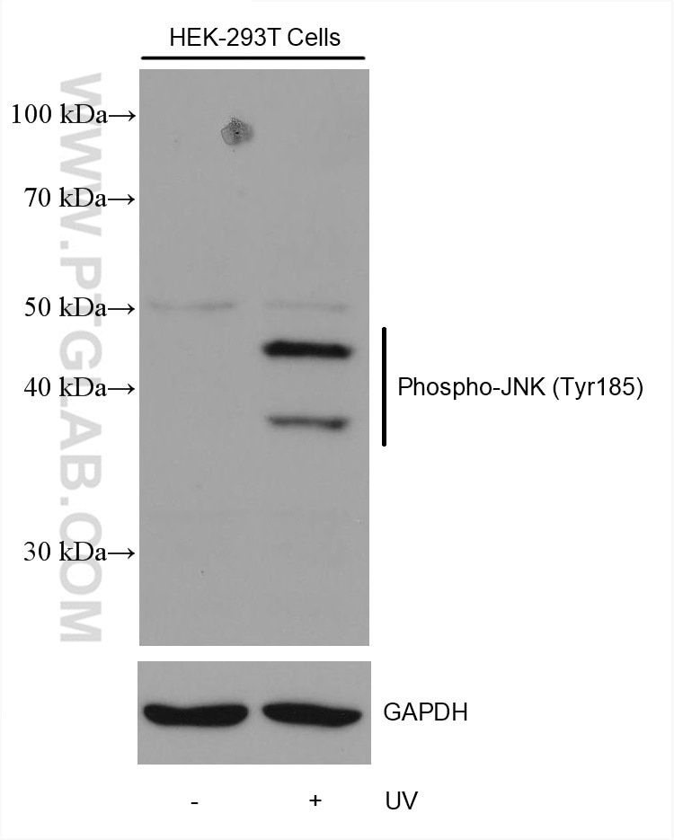 Western Blot (WB) analysis of various lysates using Phospho-JNK (Tyr185) Recombinant antibody (80024-1-RR)