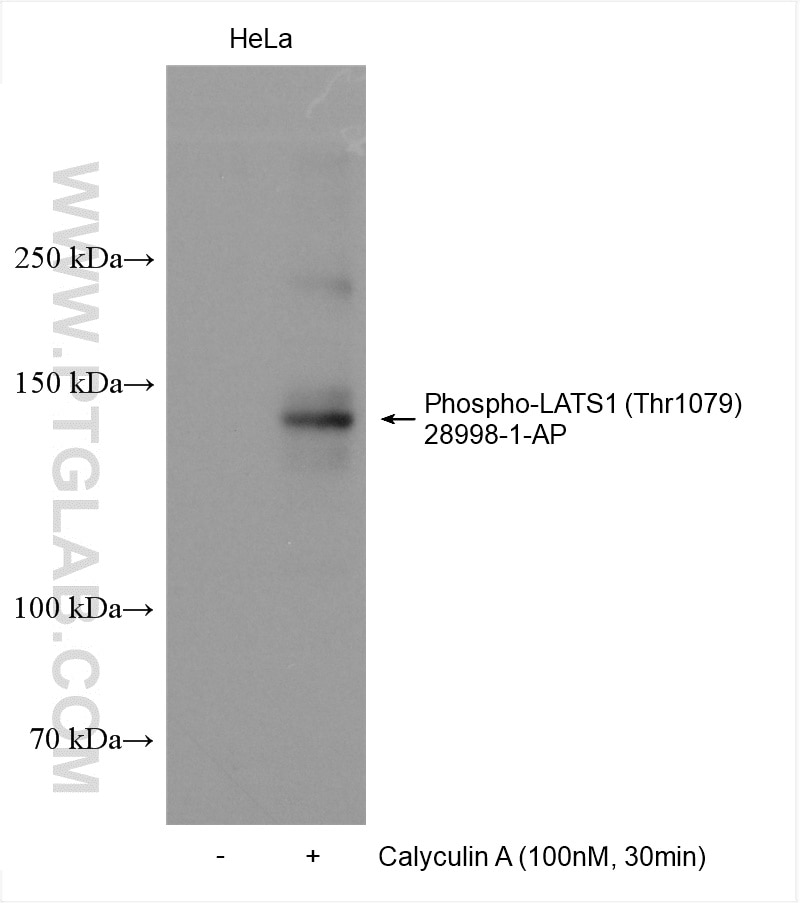 Western Blot (WB) analysis of various lysates using Phospho-LATS1 (Thr1079) Polyclonal antibody (28998-1-AP)