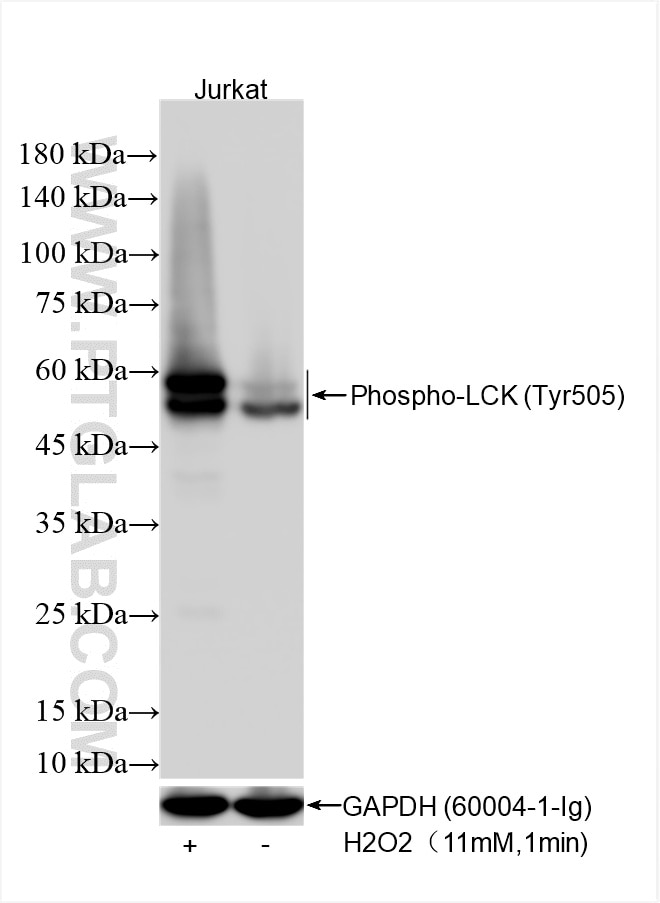 Western Blot (WB) analysis of various lysates using Phospho-LCK (Tyr505) Recombinant antibody (85679-1-RR)