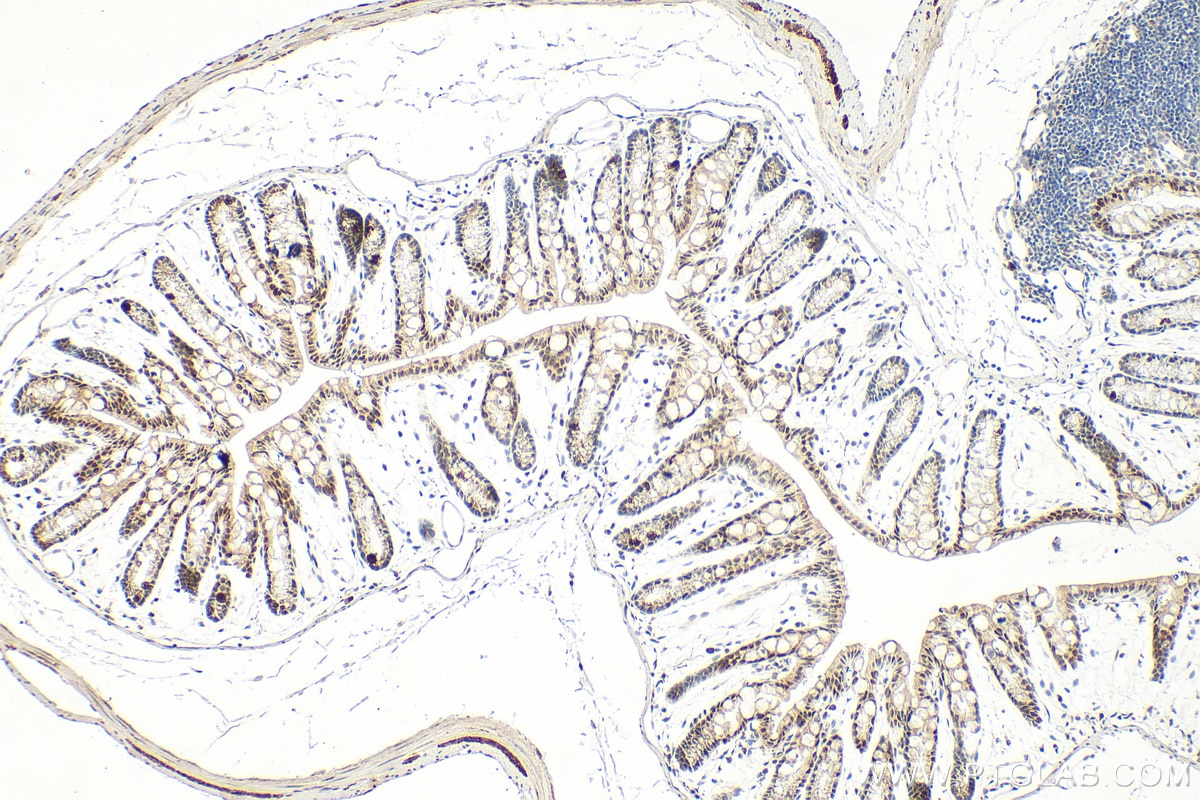 Immunohistochemistry (IHC) staining of mouse colon tissue using Phospho-Lamin A/C (Ser22) Recombinant monoclonal a (87346-1-RR)