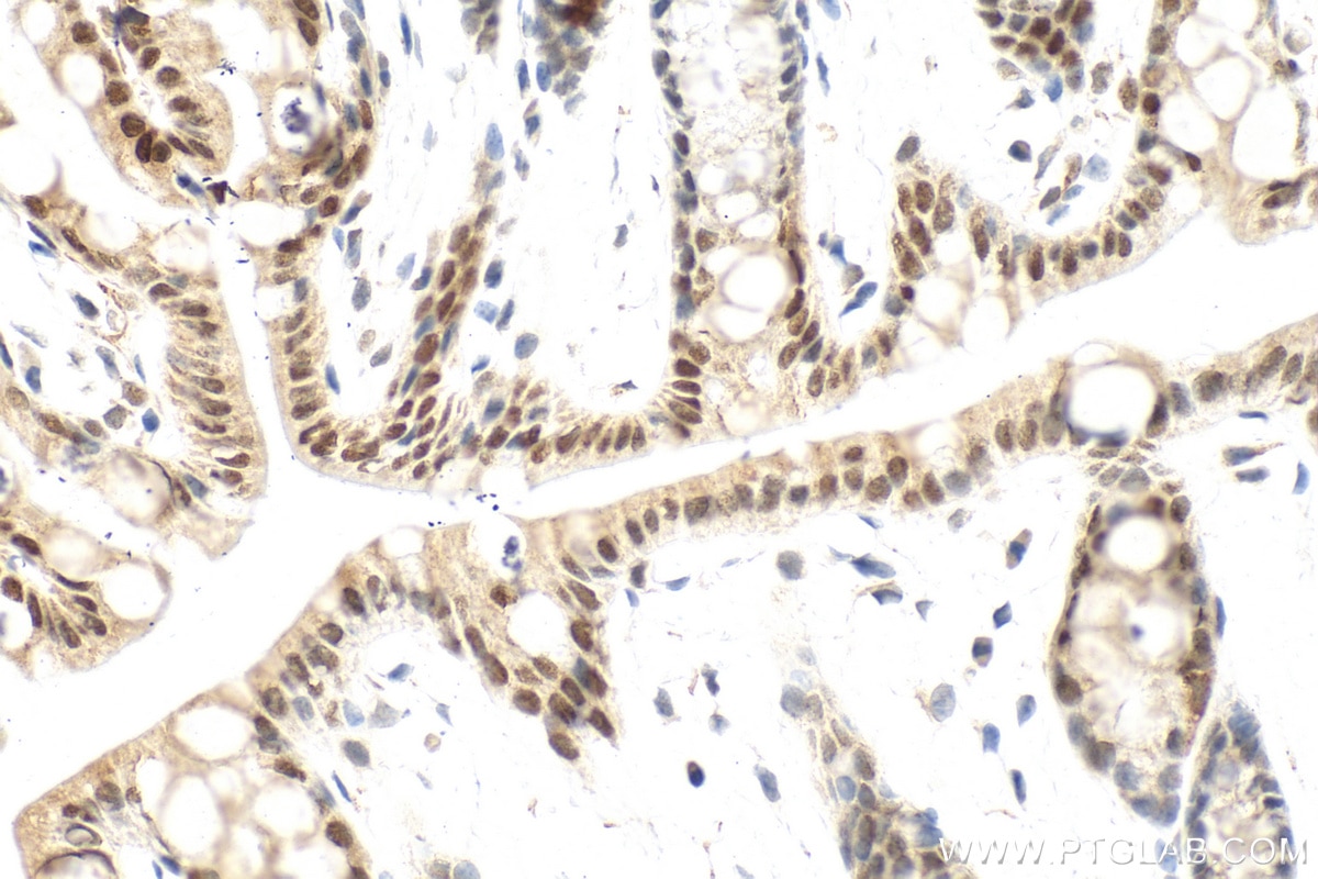 Immunohistochemistry (IHC) staining of mouse colon tissue using Phospho-Lamin A/C (Ser22) Recombinant monoclonal a (87346-1-RR)