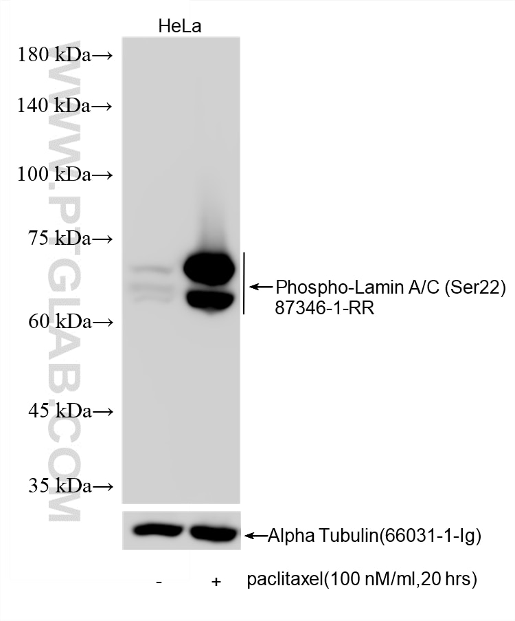 Western Blot (WB) analysis of various lysates using Phospho-Lamin A/C (Ser22) Recombinant monoclonal a (87346-1-RR)