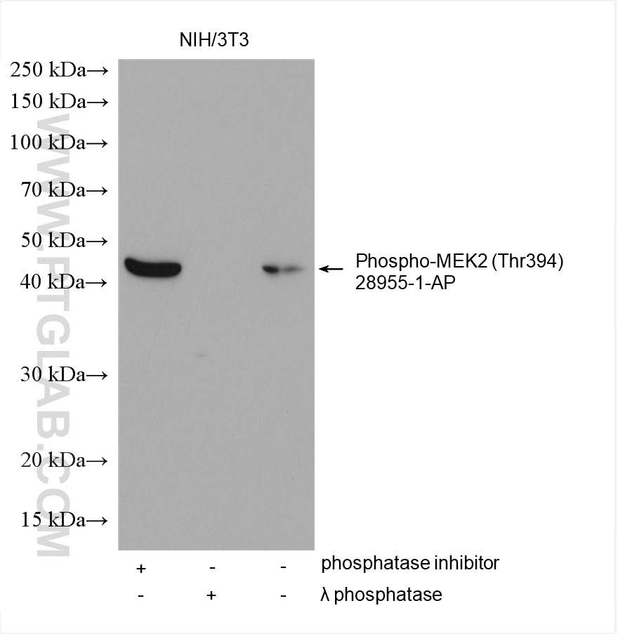 Western Blot (WB) analysis of various lysates using Phospho-MEK2 (Thr394) Polyclonal antibody (28955-1-AP)