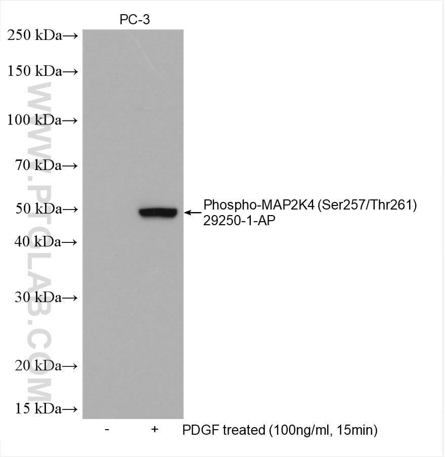 Phospho-MAP2K4 (Ser257/Thr261)