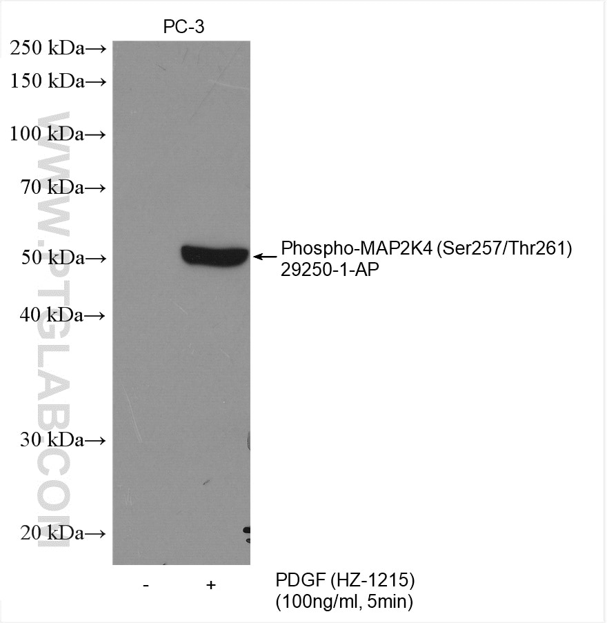 Western Blot (WB) analysis of various lysates using Phospho-MAP2K4 (Ser257/Thr261) Polyclonal antibody (29250-1-AP)