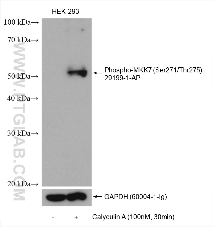 Western Blot (WB) analysis of various lysates using Phospho-MKK7 (Ser271/Thr275) Polyclonal antibody (29199-1-AP)