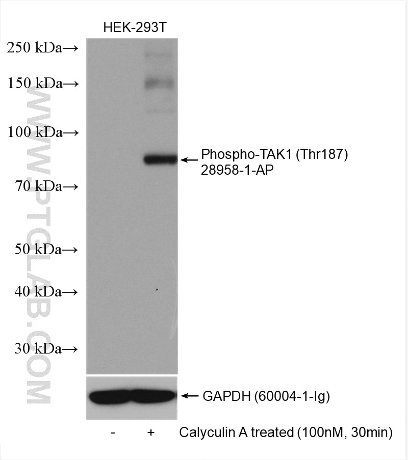 Western Blot (WB) analysis of various lysates using Phospho-TAK1 (Thr187) Polyclonal antibody (28958-1-AP)