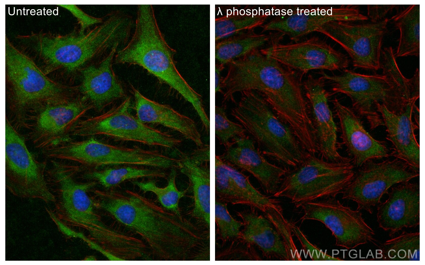 IF Staining of HeLa using 29145-1-AP