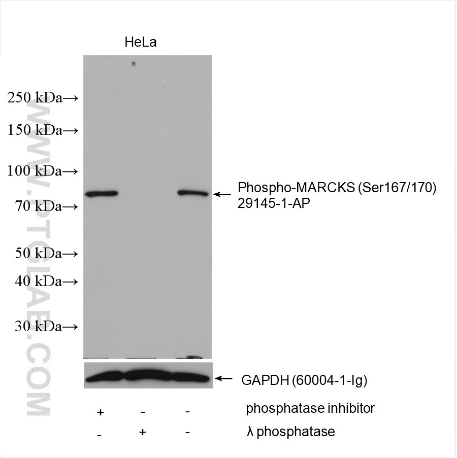 WB analysis of HeLa using 29145-1-AP