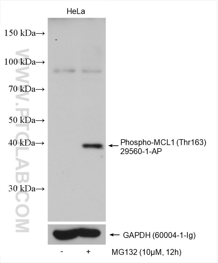Phospho-MCL1 (Thr163)