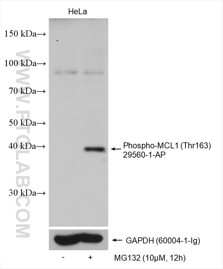 Western Blot (WB) analysis of various lysates using Phospho-MCL1 (Thr163) Polyclonal antibody (29560-1-AP)