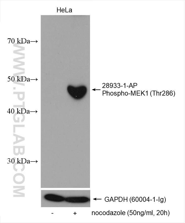 Western Blot (WB) analysis of various lysates using Phospho-MEK1 (Thr286) Polyclonal antibody (28933-1-AP)