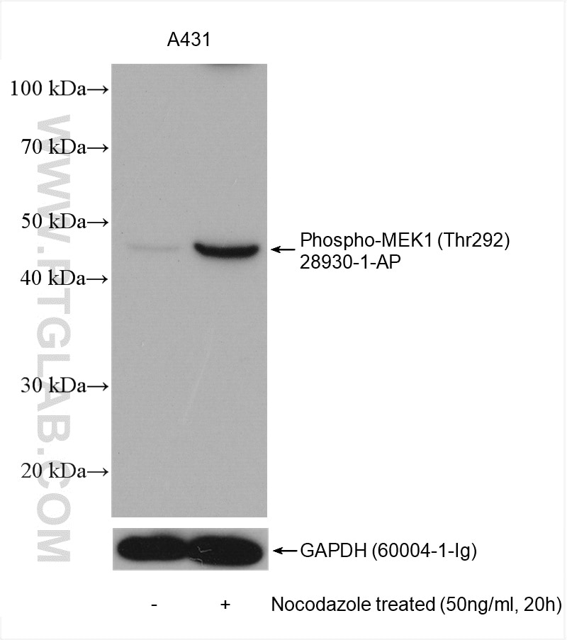 Western Blot (WB) analysis of various lysates using Phospho-MEK1 (Thr292) Polyclonal antibody (28930-1-AP)