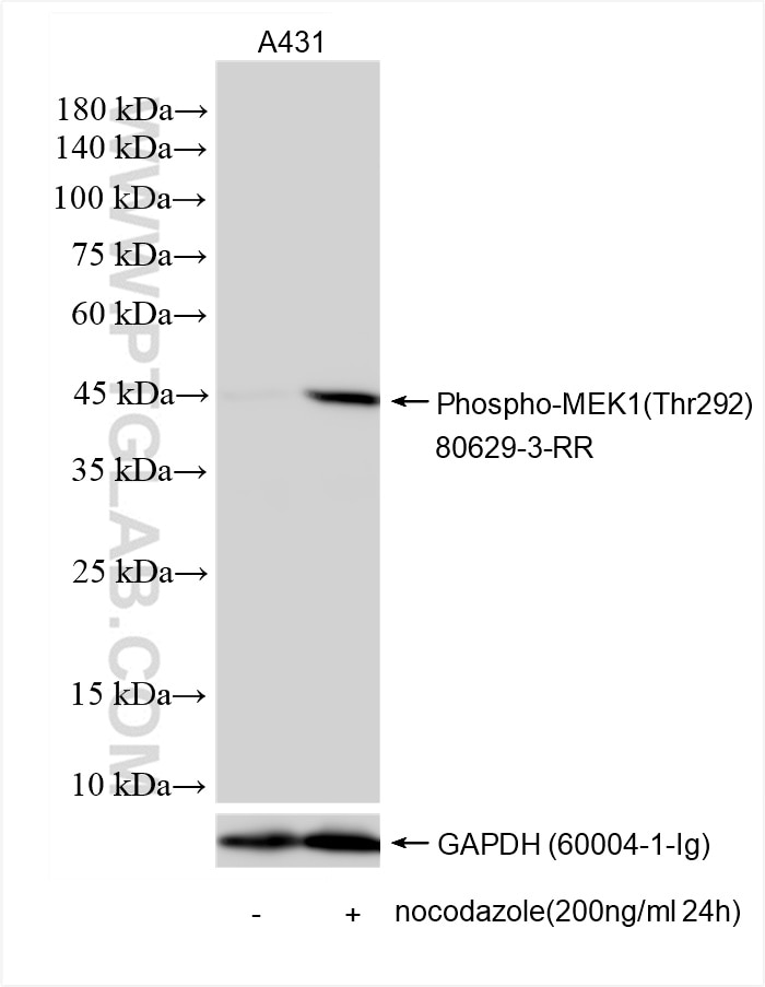 Western Blot (WB) analysis of various lysates using Phospho-MEK1 (Thr292) Recombinant antibody (80629-3-RR)