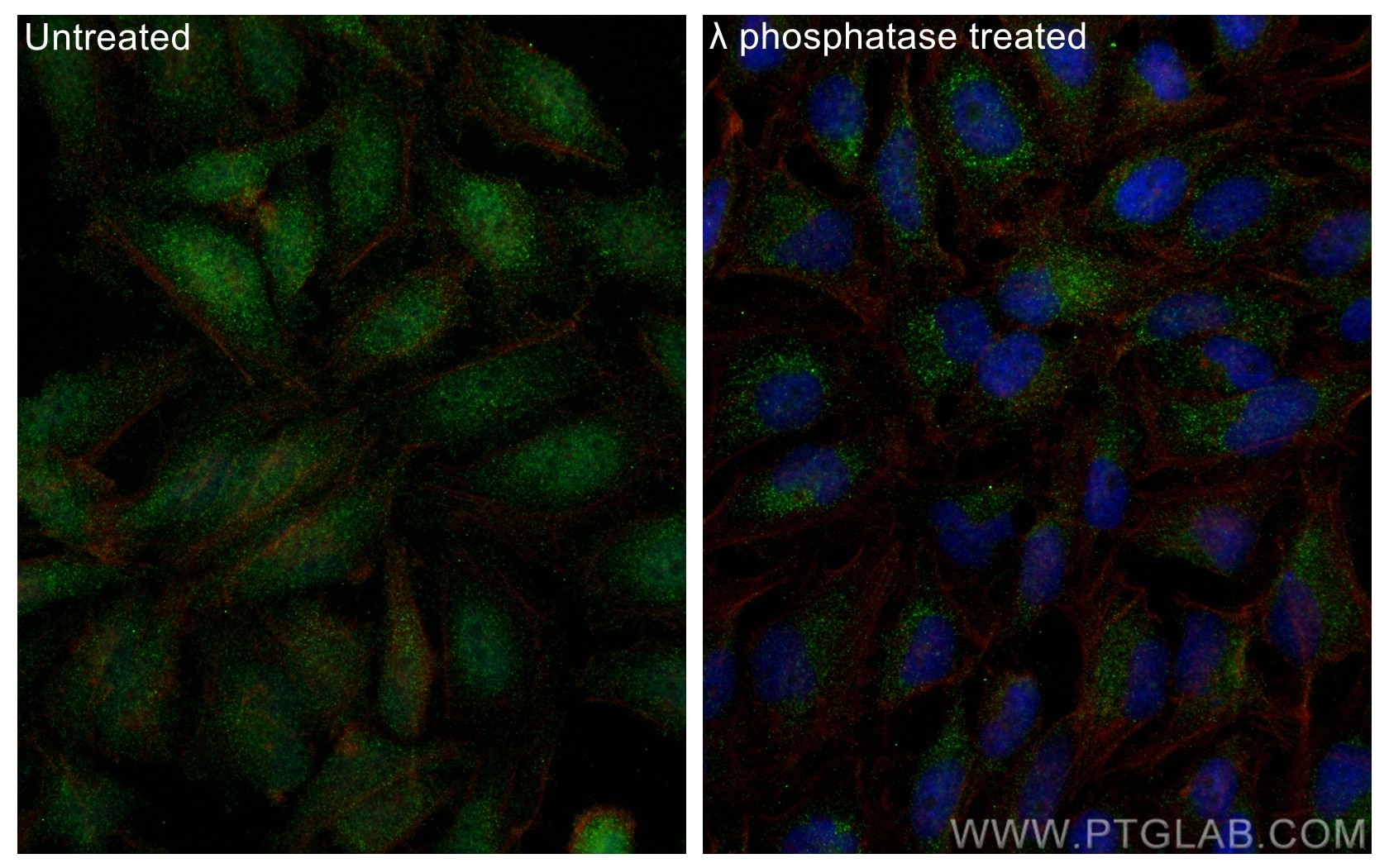 Immunofluorescence (IF) / fluorescent staining of HeLa cells using Phospho-MEK1 (Thr386) Polyclonal antibody (28935-1-AP)