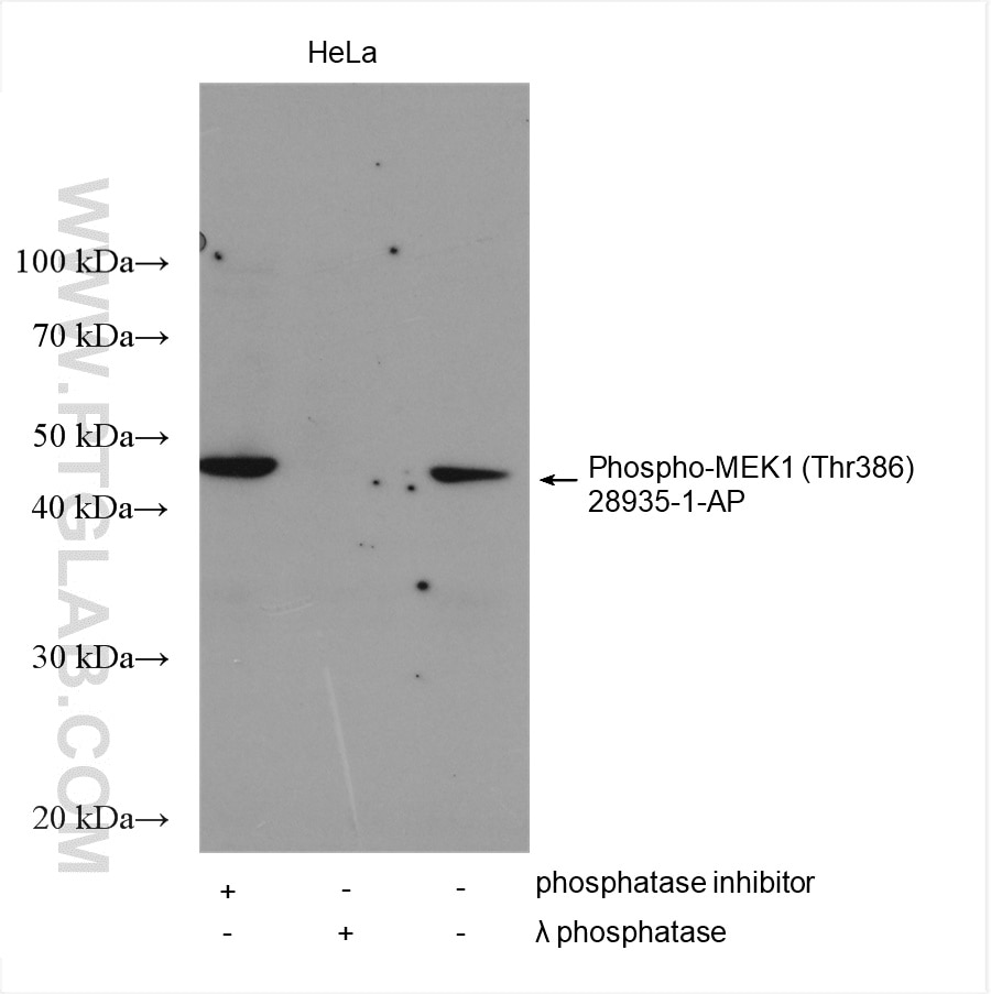 Western Blot (WB) analysis of various lysates using Phospho-MEK1 (Thr386) Polyclonal antibody (28935-1-AP)