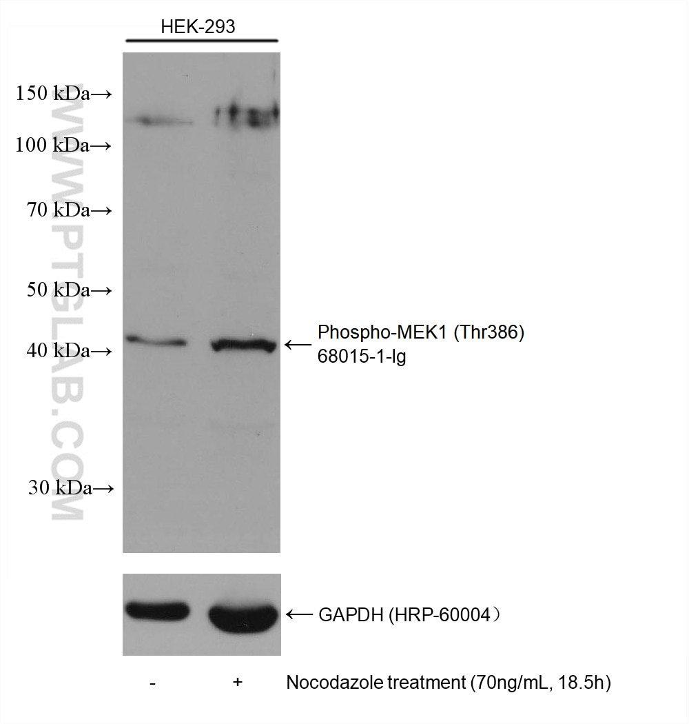 Western Blot (WB) analysis of various lysates using Phospho-MEK1 (Thr386) Monoclonal antibody (68015-1-Ig)