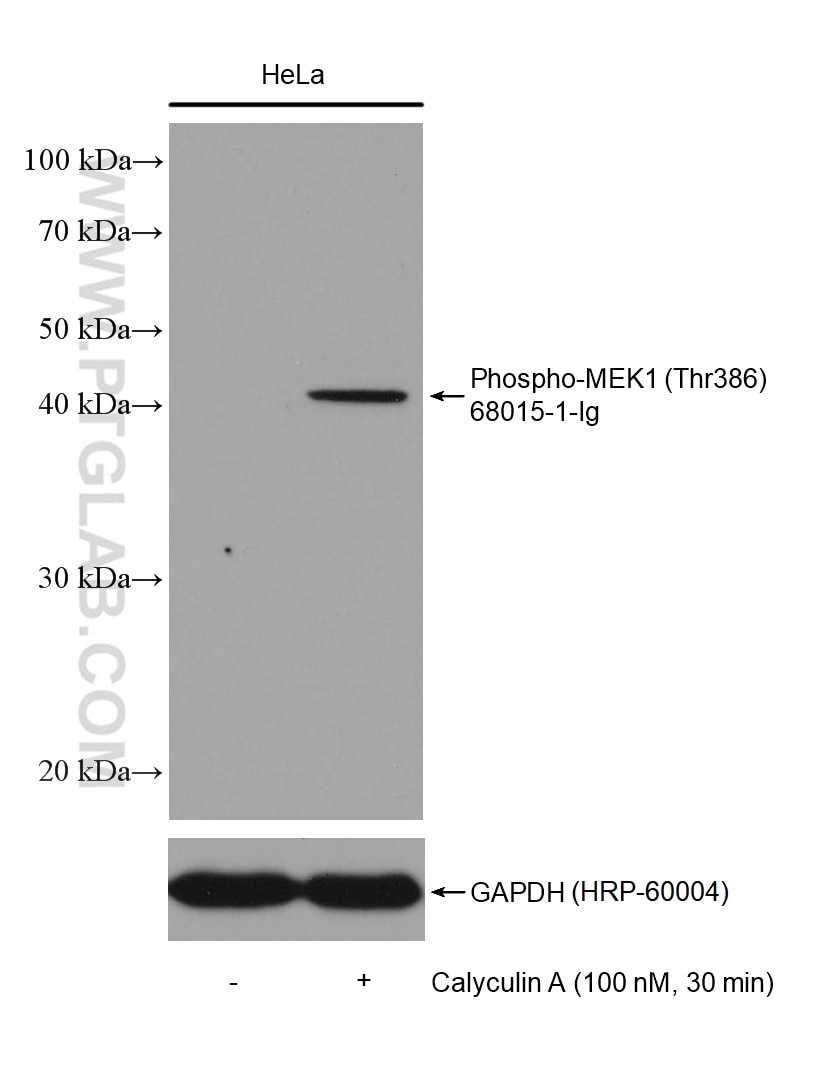 Western Blot (WB) analysis of HeLa cells using Phospho-MEK1 (Thr386) Monoclonal antibody (68015-1-Ig)