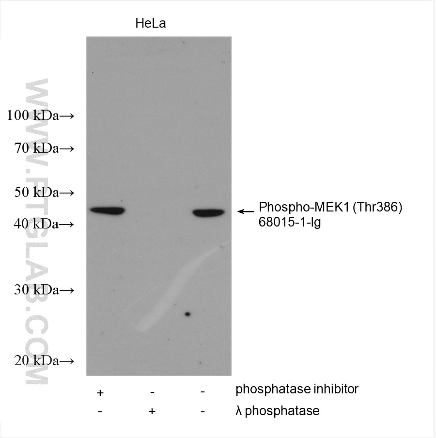 Western Blot (WB) analysis of various lysates using Phospho-MEK1 (Thr386) Monoclonal antibody (68015-1-Ig)