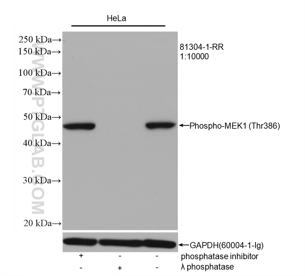 WB analysis of HeLa using 81304-1-RR