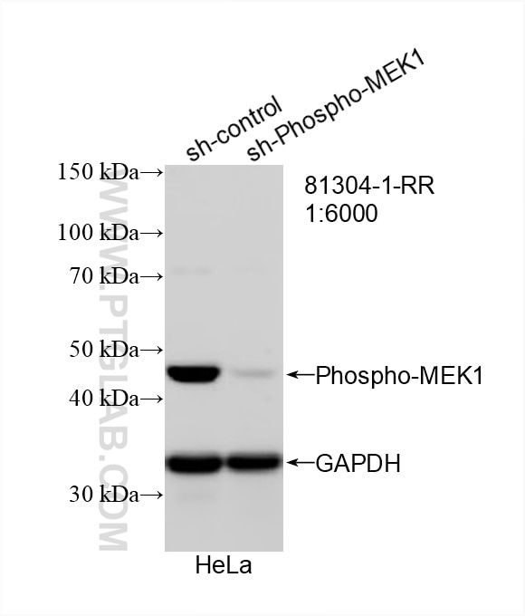 WB analysis of HeLa using 81304-1-RR