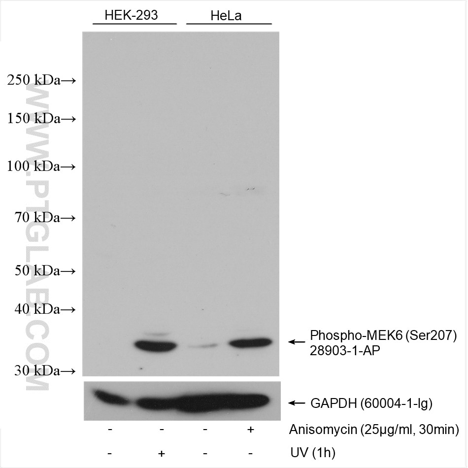 Western Blot (WB) analysis of various lysates using Phospho-MEK6 (Ser207) Polyclonal antibody (28903-1-AP)