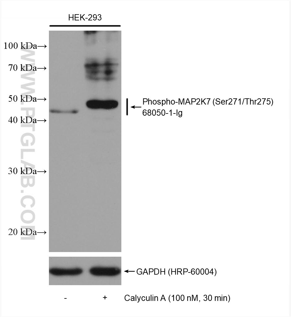 Western Blot (WB) analysis of various lysates using Phospho-MKK7 (Ser271/Thr275) Monoclonal antibody (68050-1-Ig)