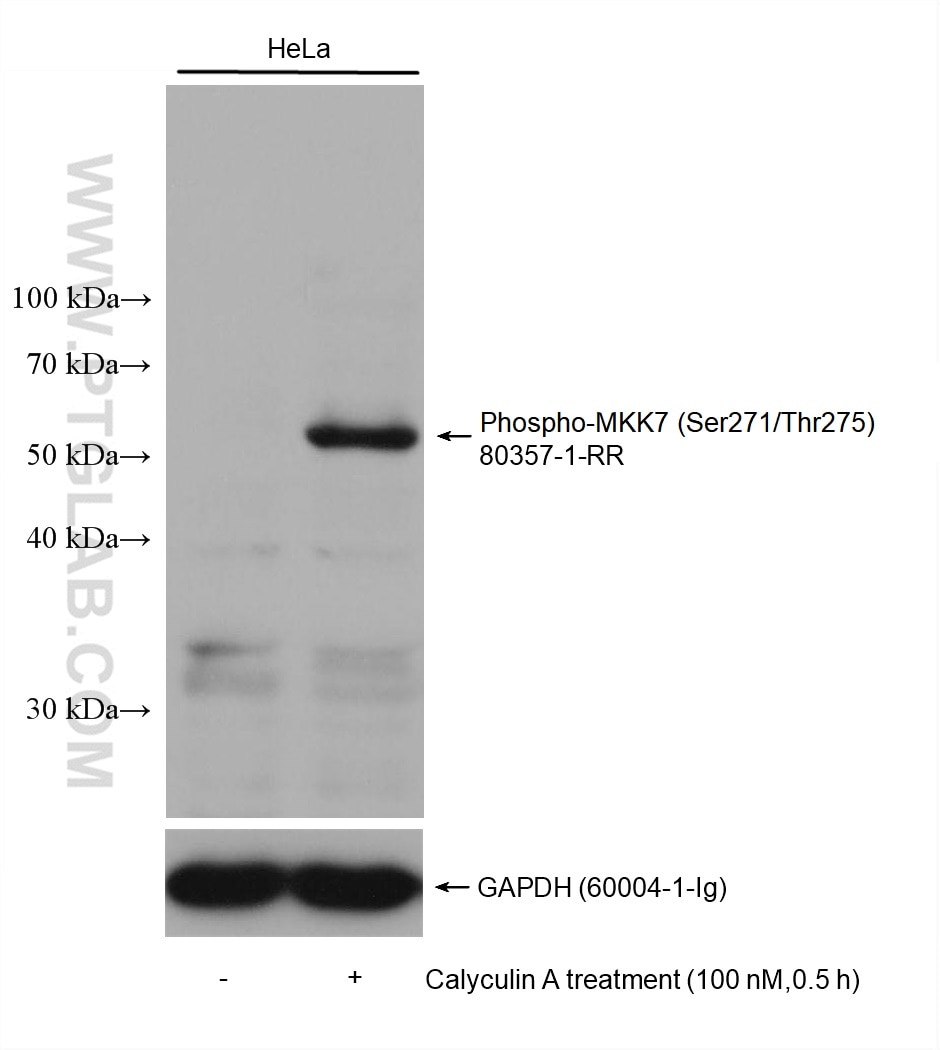 Western Blot (WB) analysis of various lysates using Phospho-MKK7 (Ser271/Thr275) Recombinant antibody (80357-1-RR)