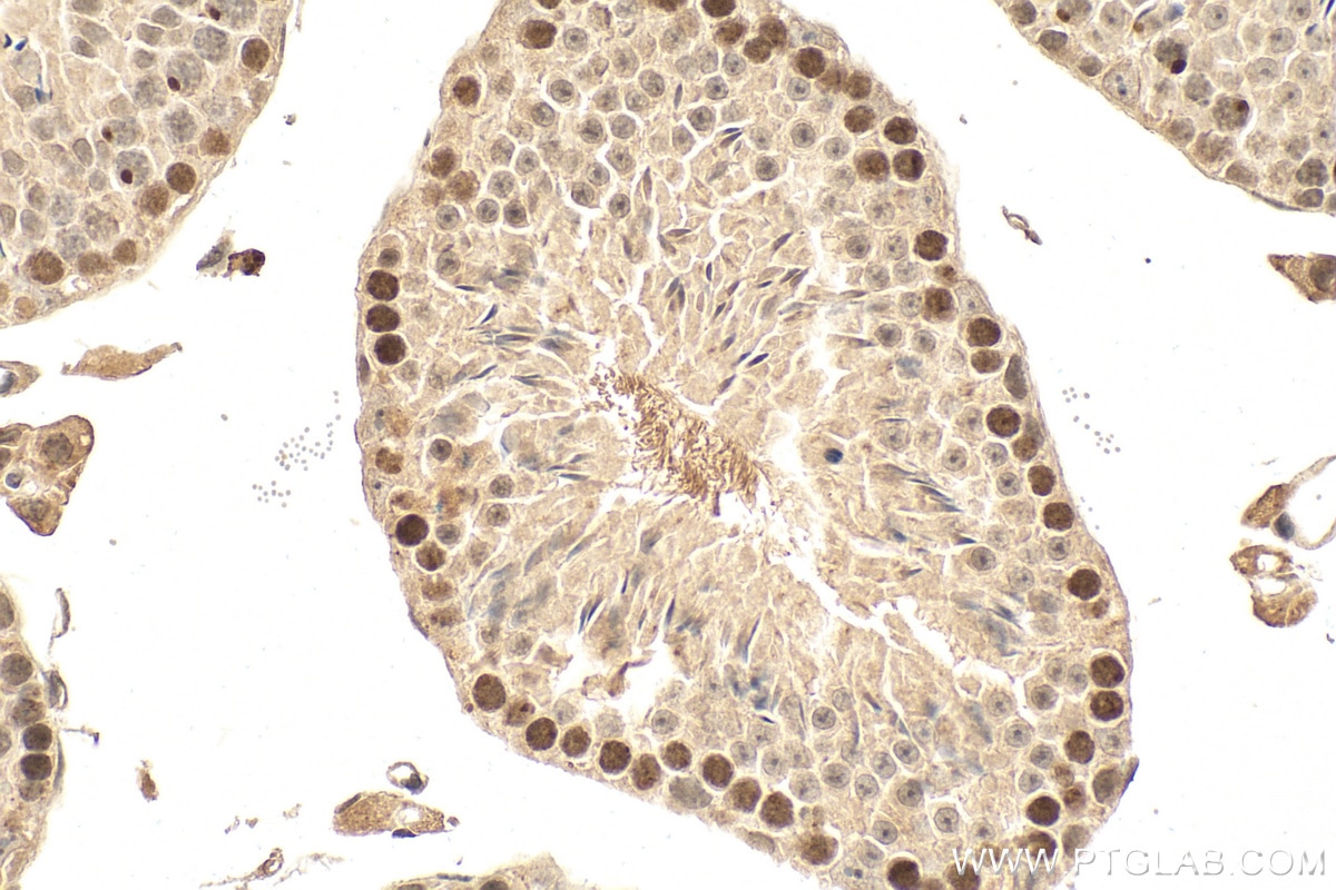 Immunohistochemistry (IHC) staining of mouse testis tissue using Phospho-MNK1 (Thr250/255) Recombinant monoclonal a (81398-1-RR)