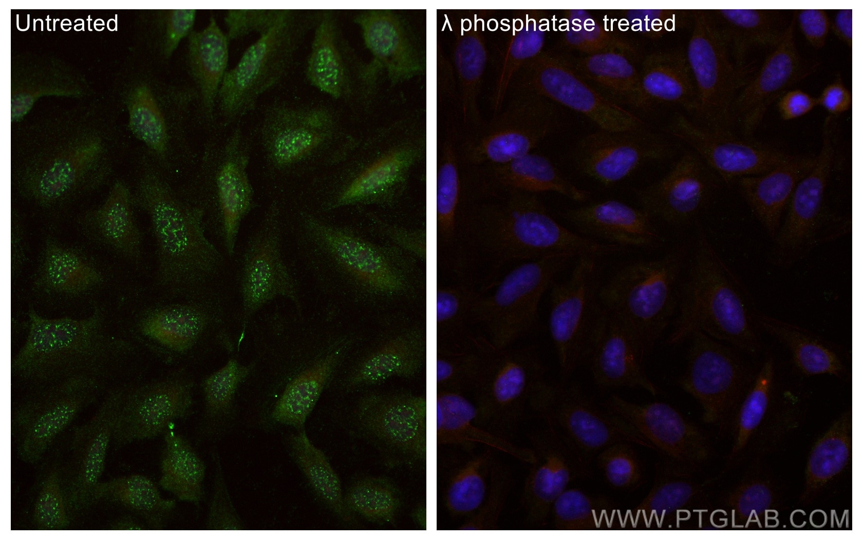 Immunofluorescence (IF) / fluorescent staining of U2OS cells using Phospho-MOBKL1B (Thr12) Polyclonal antibody (29027-1-AP)