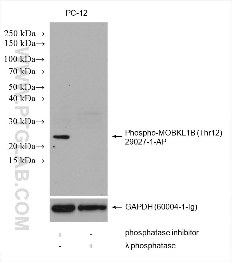 Western Blot (WB) analysis of various lysates using Phospho-MOBKL1B (Thr12) Polyclonal antibody (29027-1-AP)