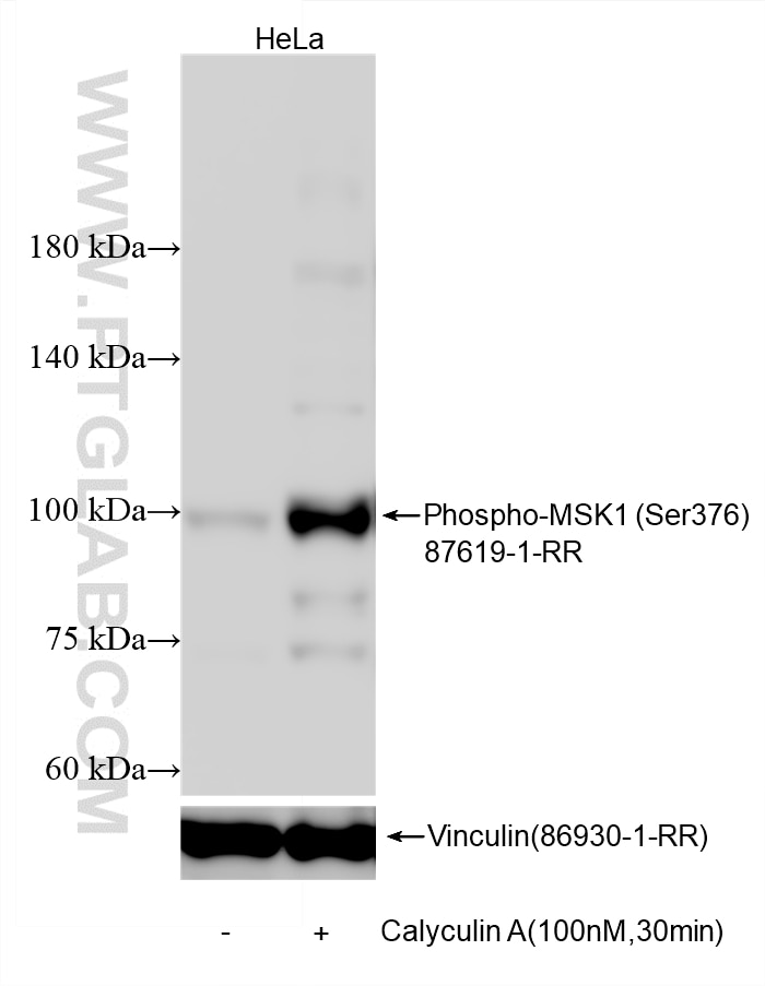 Western Blot (WB) analysis of various lysates using Phospho-MSK1 (Ser376) Recombinant monoclonal antib (87619-1-RR)