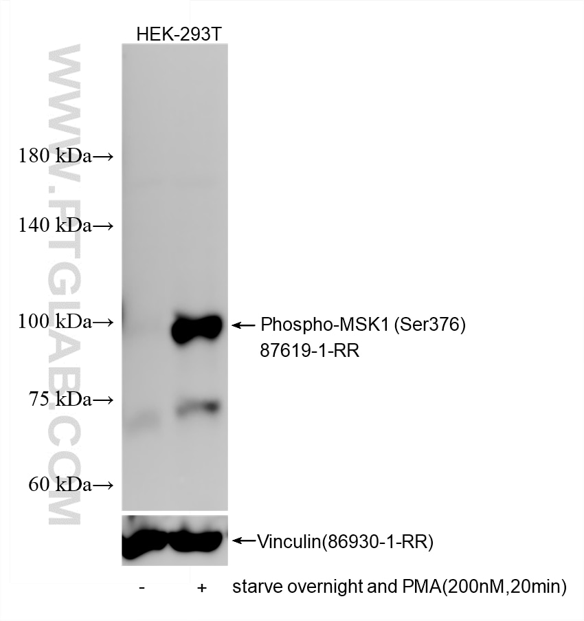 Western Blot (WB) analysis of various lysates using Phospho-MSK1 (Ser376) Recombinant monoclonal antib (87619-1-RR)