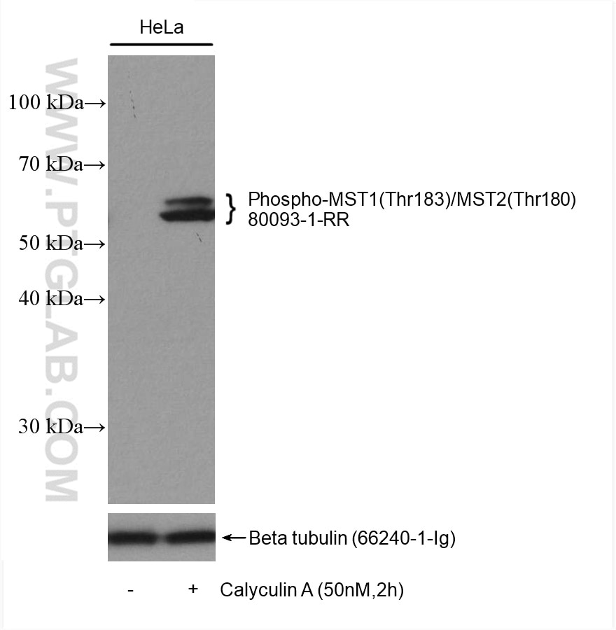 Western Blot (WB) analysis of various lysates using Phospho-MST1 (Thr183)/MST2 (Thr180) Recombinant an (80093-1-RR)