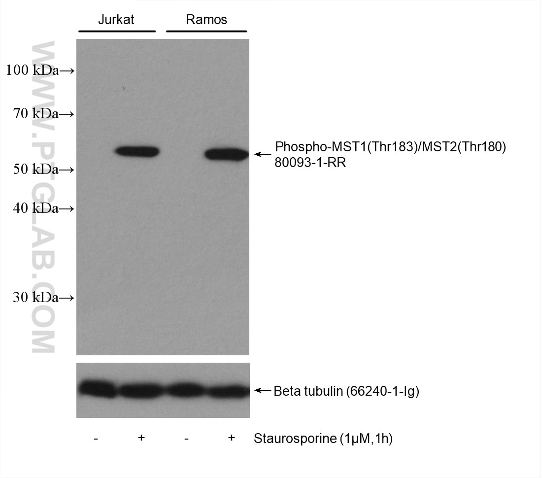 Western Blot (WB) analysis of various lysates using Phospho-MST1 (Thr183)/MST2 (Thr180) Recombinant an (80093-1-RR)
