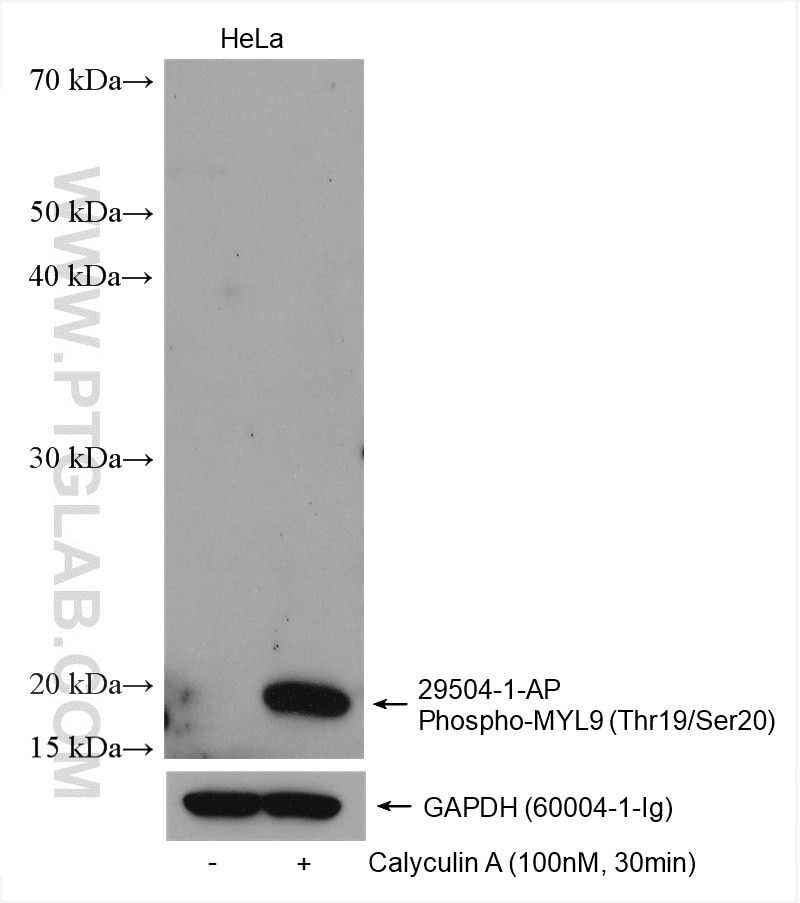 WB analysis using 29504-1-AP