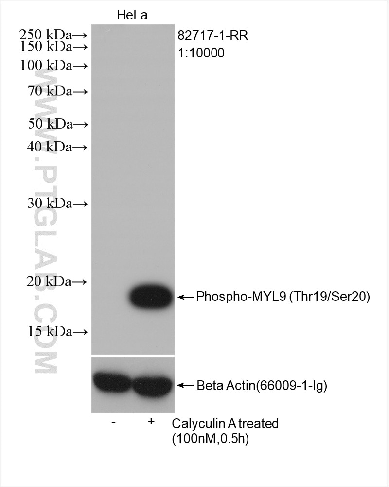 Western Blot (WB) analysis of various lysates using Phospho-MYL9 (Thr19/Ser20)  Recombinant antibody (82717-1-RR)