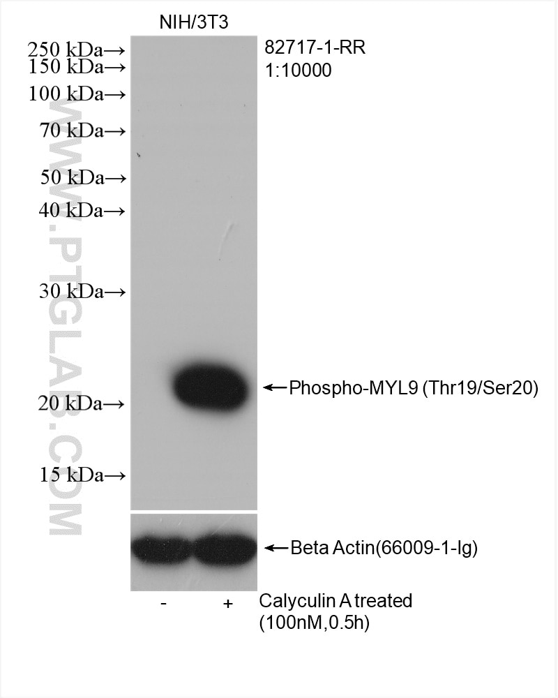 Western Blot (WB) analysis of various lysates using Phospho-MYL9 (Thr19/Ser20)  Recombinant antibody (82717-1-RR)