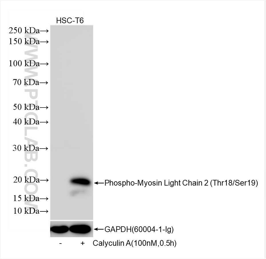 Phospho-Myosin Light Chain 2 (Thr18/Ser19)
