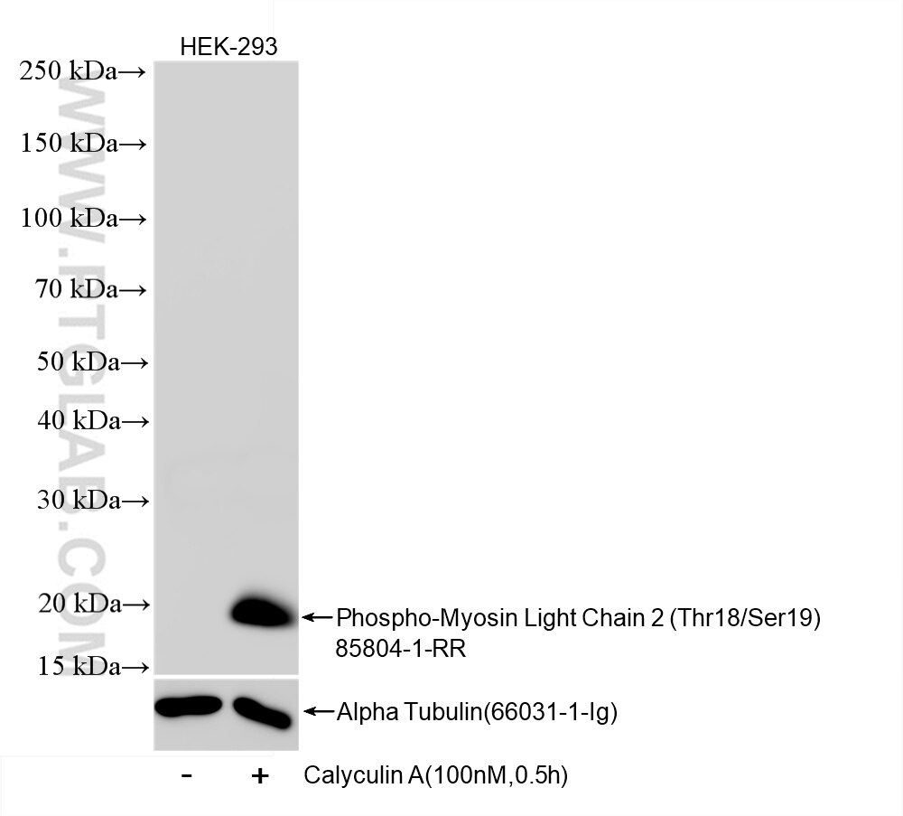 Western Blot (WB) analysis of HEK-293 cells using Phospho-Myosin Light Chain 2 (Thr18/Ser19) Recombi (85804-1-RR)