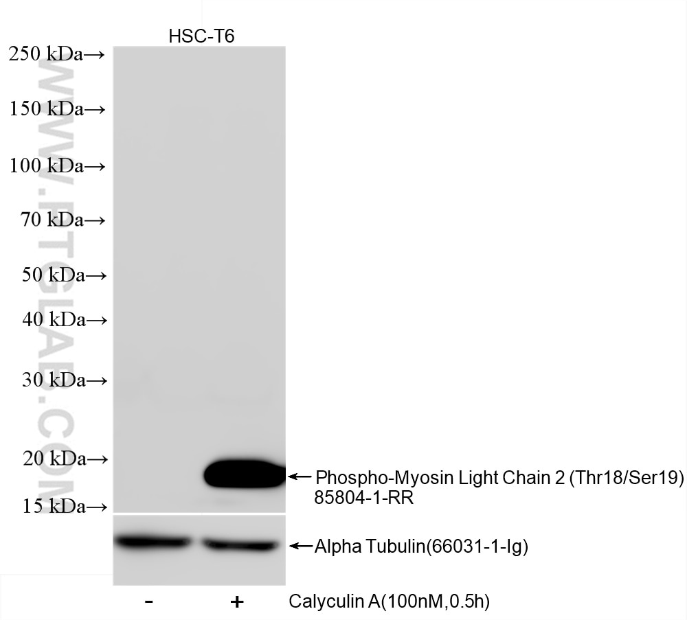 Western Blot (WB) analysis of HSC-T6 cells using Phospho-Myosin Light Chain 2 (Thr18/Ser19) Recombi (85804-1-RR)