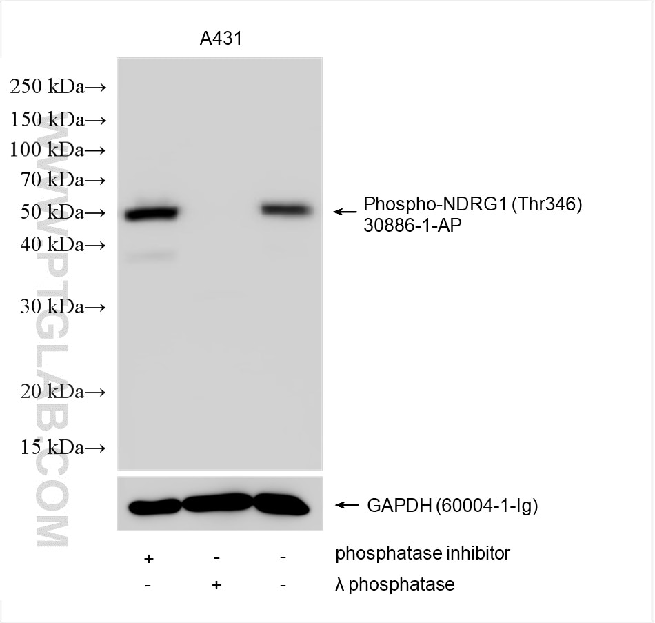 Phospho-NDRG1 (Thr346)