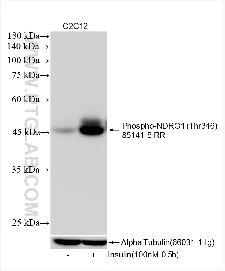 Phospho-NDRG1 (Thr346)