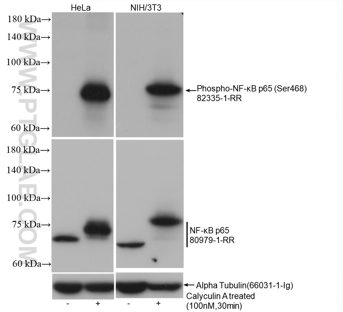 Western Blot (WB) analysis of various lysates using Phospho-NF-κB p65 (Ser468) Recombinant antibody (82335-1-RR)