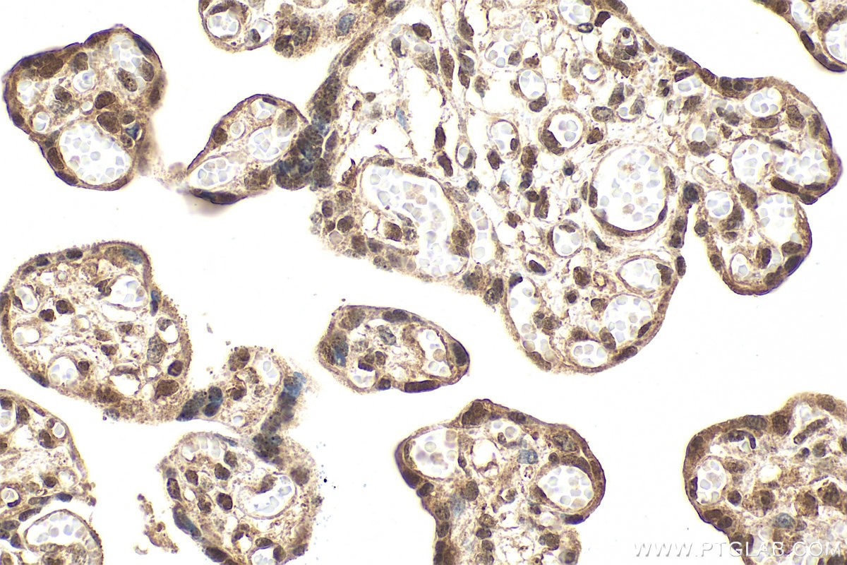 Immunohistochemistry (IHC) staining of human placenta tissue using Phospho-NF-κB p65 (Ser536) Recombinant monoclonal  (80379-2-RR)