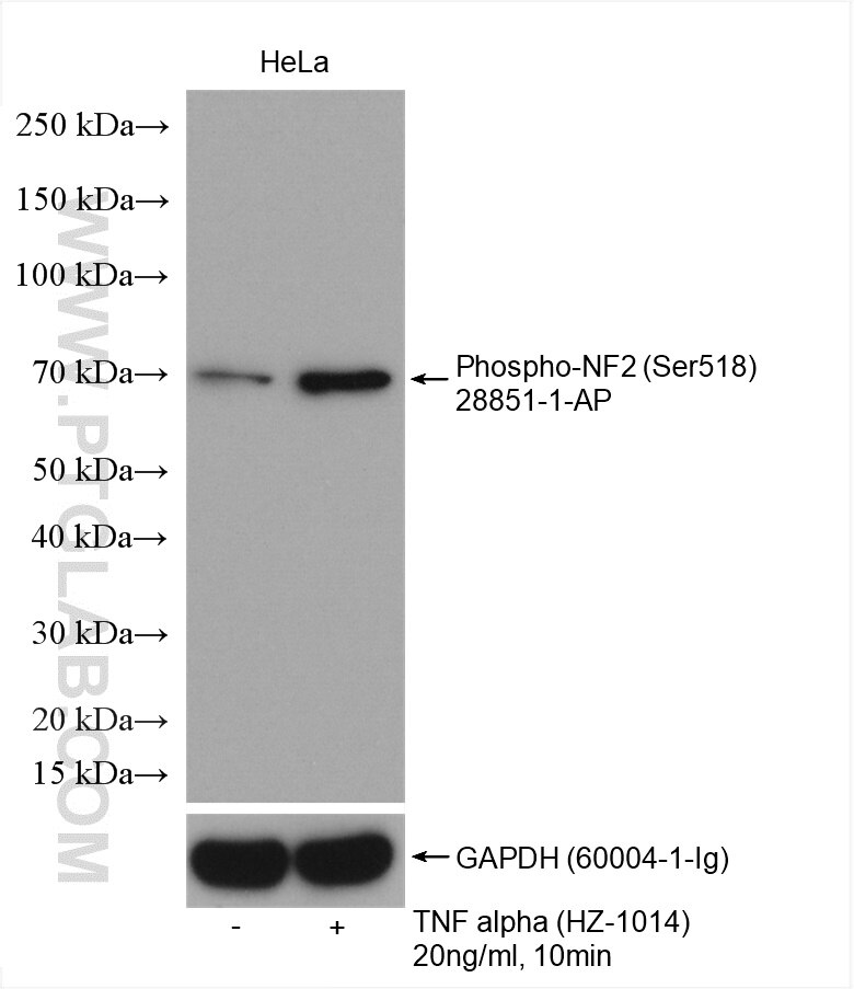 Phospho-NF2 (Ser518)