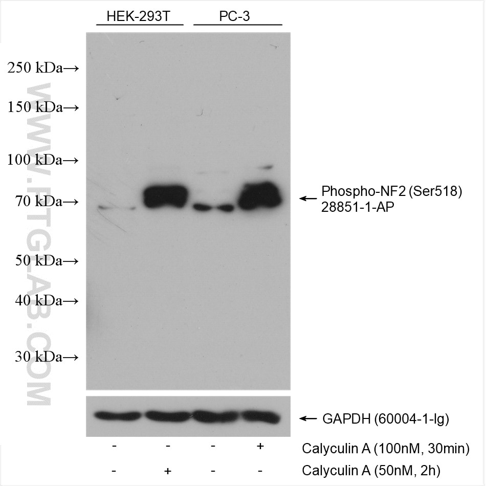 Western Blot (WB) analysis of various lysates using Phospho-NF2 (Ser518) Polyclonal antibody (28851-1-AP)